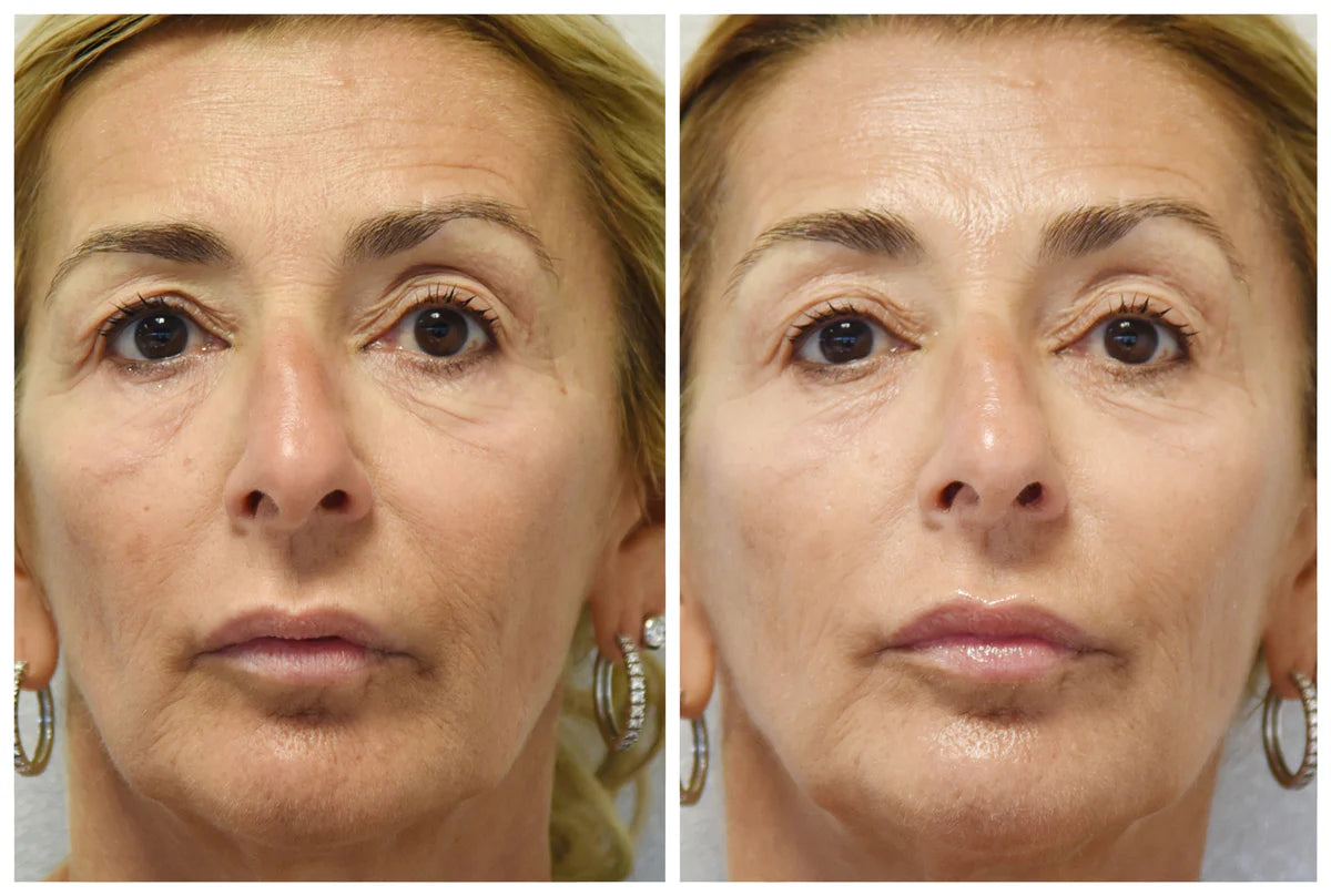 I MASK Maschera Viso Equilibrante e tonificante