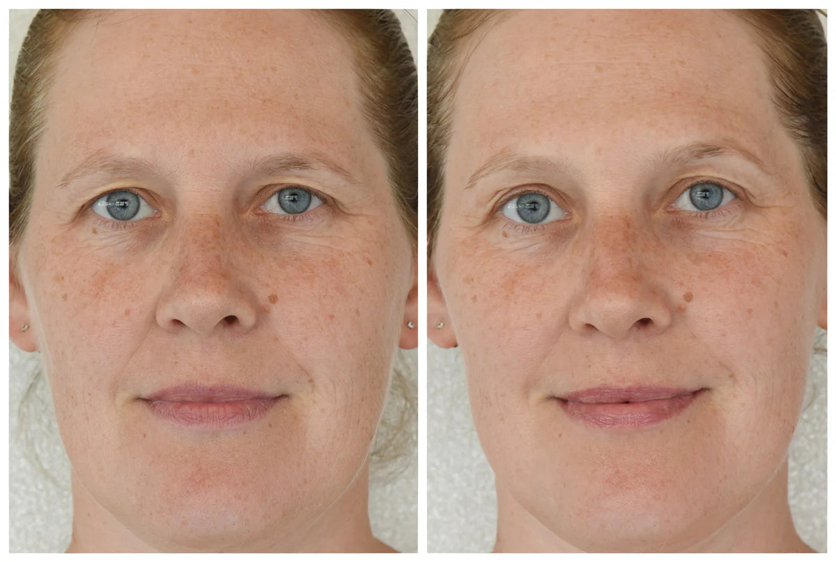 MD Restoring FACIAL CLEANSER